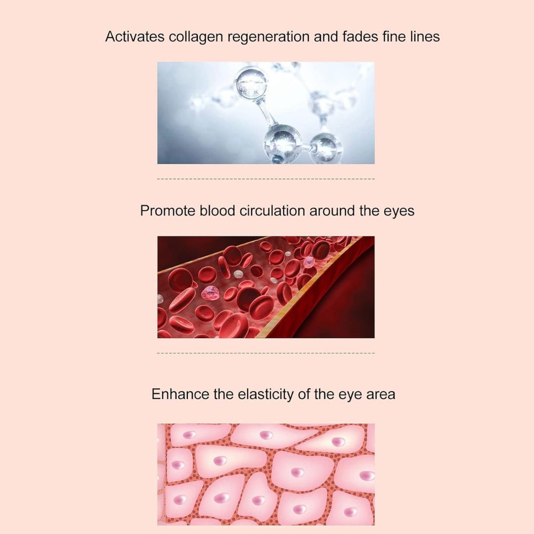 EyeLume™ – RF Anti-Aging Eye Massager